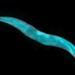 Некоторое напряжение в молодости продлевает продолжительность жизни, показывают исследования круглых червей