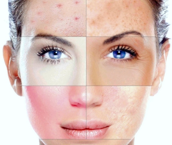 Исследование объясняет, почему некоторые кремы и косметика могут вызвать кожную сыпь
