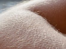 Причина появления мурашек на коже